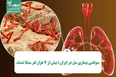 سونامی بیماری سل در ایران ؛ بیش از ۷ هزار نفر مبتلا شدند