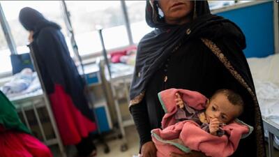 فوت روزانه بیش از ۱۹۰ مادر و نوزاد در افغانستان