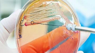 آنتی‌بیوتیک جدیدی که با باکتری‌های خوب کاری ندارد