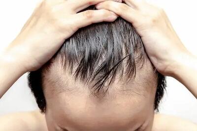 این ژل طبیعی موهای شما را تقویت می‌کند +طرز ساخت ژل مو در خانه