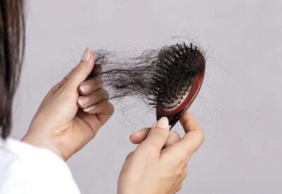 شش عامل ریزش موی سر زنان + راهکار