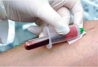 crp در آزمایش خون - اندیشه معاصر