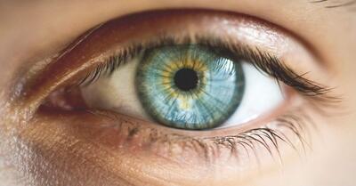 هتروکرومیا؛ زیبایی یک اختلال چشم(+تصاویر)