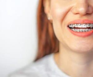 فرق متخصص ارتودنسی با دندانپزشک در چیست؟