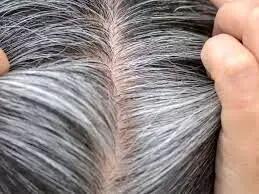 سفیدی زودرس موها پیش از ۴۰ سال چه دلایلی دارد؟ + راه‌های درمان آن