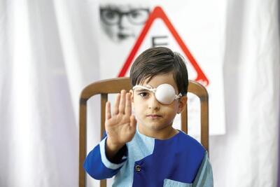 «۵ سالگی» بهترین زمان درمان تنبلی چشم