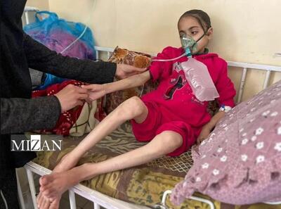ابتلای ۸ هزار کودک به سوءتغذیه در غزه؛ ۳ هزار کودک در معرض خطر مرگ