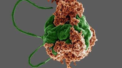 میکروربات‌های جلبکی کوچک می‌توانند درمان سرطان ریه را متحول کنند