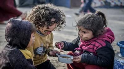 آنروا: ۵۰ هزار کودک در غزه از سوء تغذیه شدید رنج می‌برند