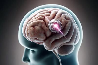 نابودی هدفمند و روشن کردن سلول‌های تومور مغزی با پرتو ایکس