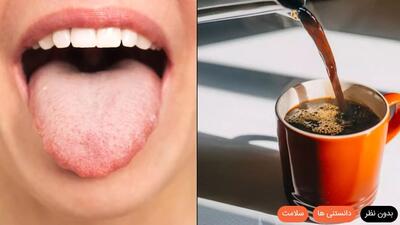 این نشانه روی زبان می‌گوید نباید قهوه بنوشید