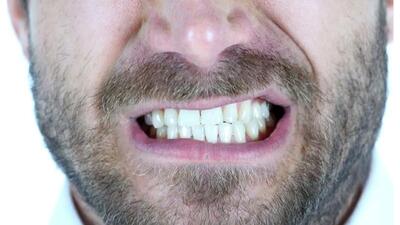 عوارض و راههای درمان طبیعی دندان قروچه