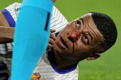 عکس؛ خونریزی بینی امباپه پس از برخورد با بازیکن اتریش