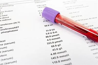 hdl در آزمایش خون چیست| مقدار نرمال HDL در آزمایش خون چقدر است؟ - اندیشه معاصر