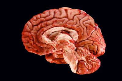 واضح‌ترین تصویر از مغز انسان ثبت شد/ عکس