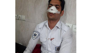 کتک خوردن امدادگر اورژانس از همراهان بیمار ! / واقعا ناجوانمردانه است ! + عکس