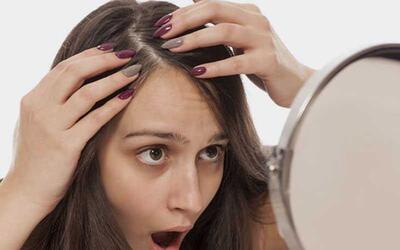 چرا موهایم می ریزد؟+ همه آنچه درباره ریزش مو باید بدانید - اندیشه معاصر