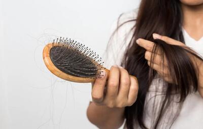ریزش مو چه زمانی غیرطبیعی است؟/ شایع ترین علل ریزش مو چیست؟