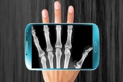رادیولوژی روی موبایل با تراشه جدید