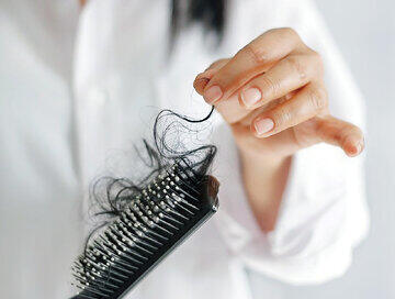 ریزش مو چه وقتی غیرطبیعی است؟ شایع ترین علل ریزش موها چیست؟ + 8 مورد که باید بدانید