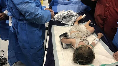 چرخ گوشت دست کودک ۲ ساله را بلعید + عکس تلخ