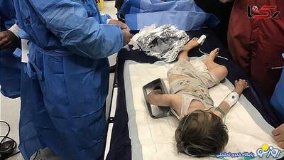 چرخ گوشت دست کودک ۲ ساله را بلعید | روزنو