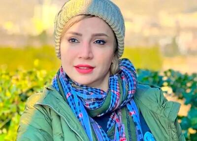 عکس های زیرخاکی از چهره بازیگران زن قبل از عمل زیبایی + اسامی باربی های ایران