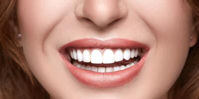 طراحی لبخند هالیوودی متناسب با چهره شما|دندانپزشکی دکتر مهدی کریمی