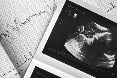 کاهش ۱۱ درصدی تشکیل پرونده‌های قانون سقط درمانی در خراسان شمالی