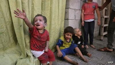 مدیر بیمارستان کمال عدوان: بیش از ۲۵۰ کودک در غزه علائم سوء تغذیه دارند