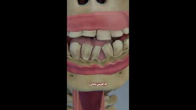 عوارض کشیدن دندان در طولانی مدت