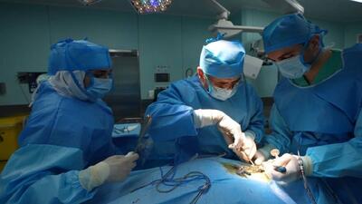 عمل نادر خارج کردن جسم خارجی از مغز در بیمارستان رضوی مشهد انجام شد