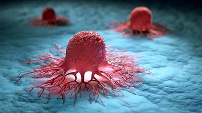حذف سلول‌های سرطانی بعد از مرگ چگونه است؟