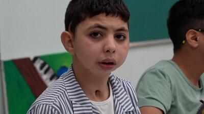 کودکان فلسطینی مجروح غزه در شهرک بشردوستی امارات دوباره طعم زندگی عادی را می‌چشند