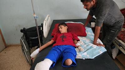 آنروا: «به طور متوسط ​​روزانه 10 کودک در غزه یک یا دو پای خود را از دست می‌دهند» | خبرگزاری بین المللی شفقنا