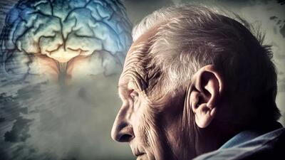 ۷ روش کاهش خطر ابتلا به آلزایمر