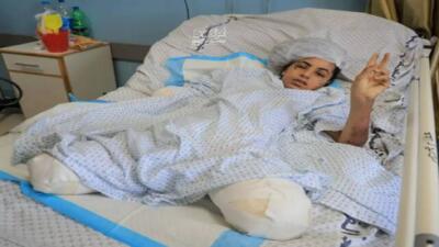 روزانه ۱۰ کودک در غزه یک یا دو پای خود را از دست می‌دهند + فیلم