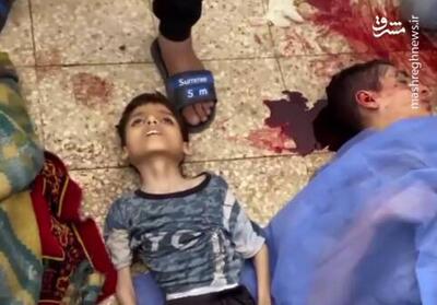 فیلم/ شهادت کودک ۹ ساله فلسطینی بر اثر سوءتغذیه(۱۶+)