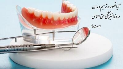آیا قصور در دندانپزشکی حق‌الناس است؟