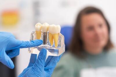 نکات مهم در مراقبت قبل و بعد از ایمپلنت دندان چیست؟