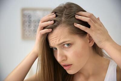 جلوگیری از ریزش مو با این ویتامین‌ها | اقتصاد24