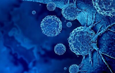 عفونت‌های سرطانی از راه دور شناسایی می‌شوند