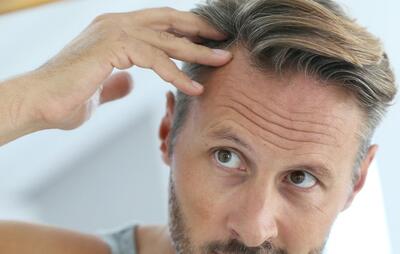 روش‌های پیشگیری و قطع ریزش موی سر