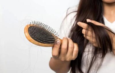 دلیل ریزش مو و درمان فوری ریزش مو: راهنمای کامل برای مقابله با ریزش مو