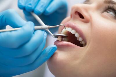 درمان پوسیدگی دندان بدون نیاز به تراشیدن