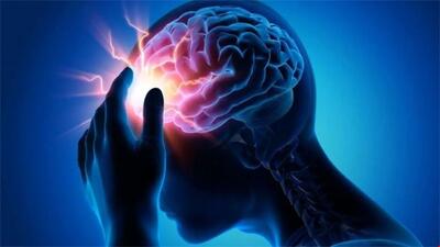 اورژانسی ترین سردرد چه علائمی دارد؟ + علائم