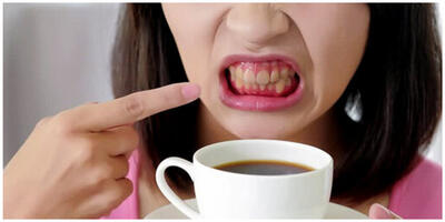 برای استفاده درست از نخ دندان این 8 نکته را رعایت کنید