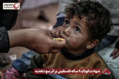 نورنما | شهادت کودک 9 ساله فلسطینی بر اثر سوءتغذیه +فیلم