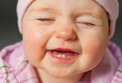 چند راه حل برای کاهش درد دندان درآوردن نوزاد