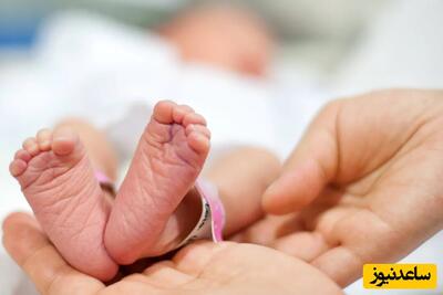 تولد نوزادی با جنین دوقلویش درون معده